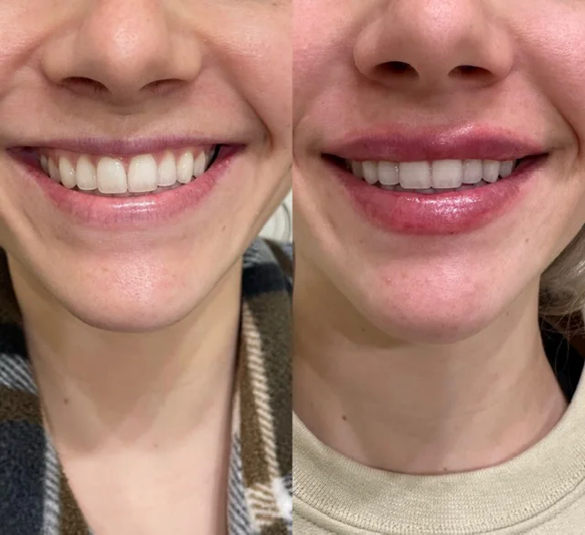 Before and After Result 3