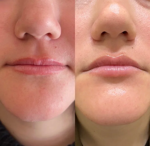 Before and After Result 4