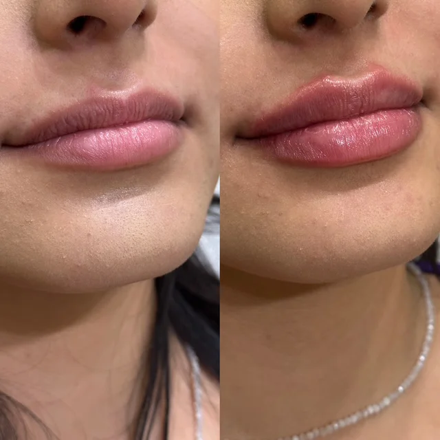 Before and After Result 6