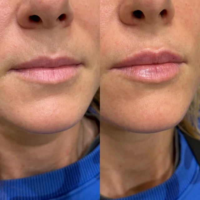 Before and After Result 9